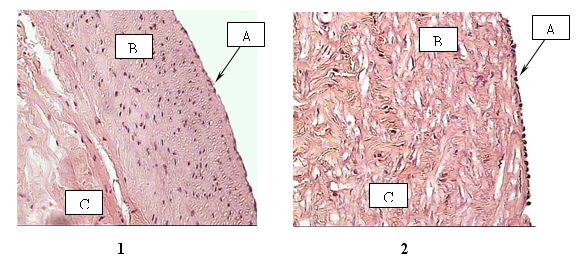 Гистологическое исследование большой подкожной вены Гистологическое исследование большой подкожной вены