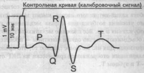 Контрольная кривая и высота основных зубцов ЭКГ Контрольная кривая и высота основных зубцов ЭКГ