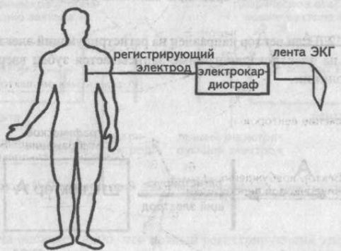 Регистрирующий электрод, электрокардиограф, лента ЭКГ Регистрирующий электрод, электрокардиограф, лента ЭКГ