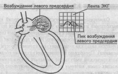 Возбуждение левого предсердия и его графическое изображение Возбуждение левого предсердия и его графическое изображение