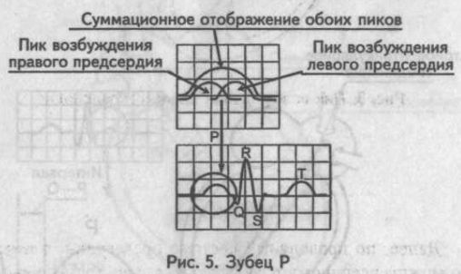 Суммационное отображение обоих пиков Суммационное отображение обоих пиков
