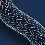 Коронарное стентирование Коронарное стентирование