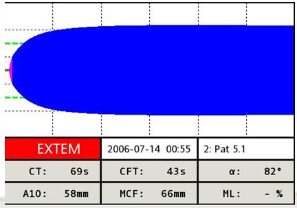 EXTEM EXTEM